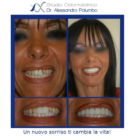 Alessandro Palumbo-21