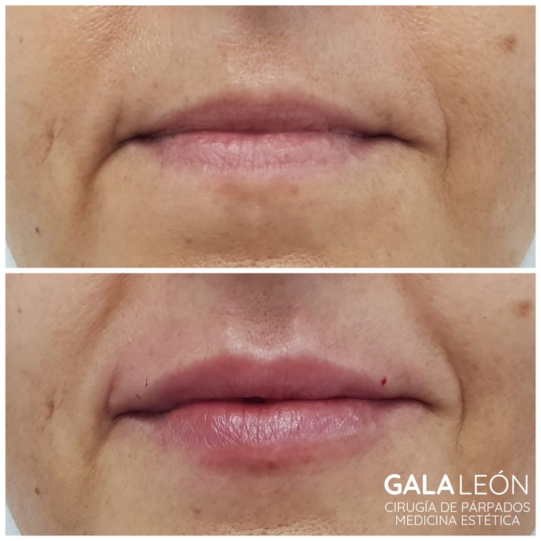 Gala P. Leon Salvatierra-22