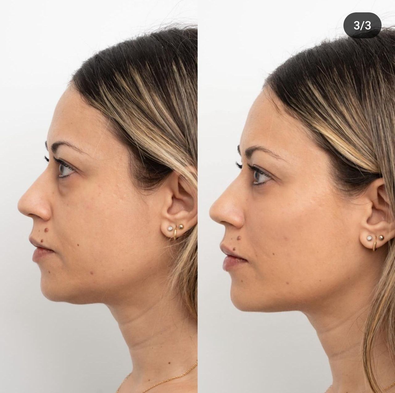 Raquel Moreno Pentinel-70