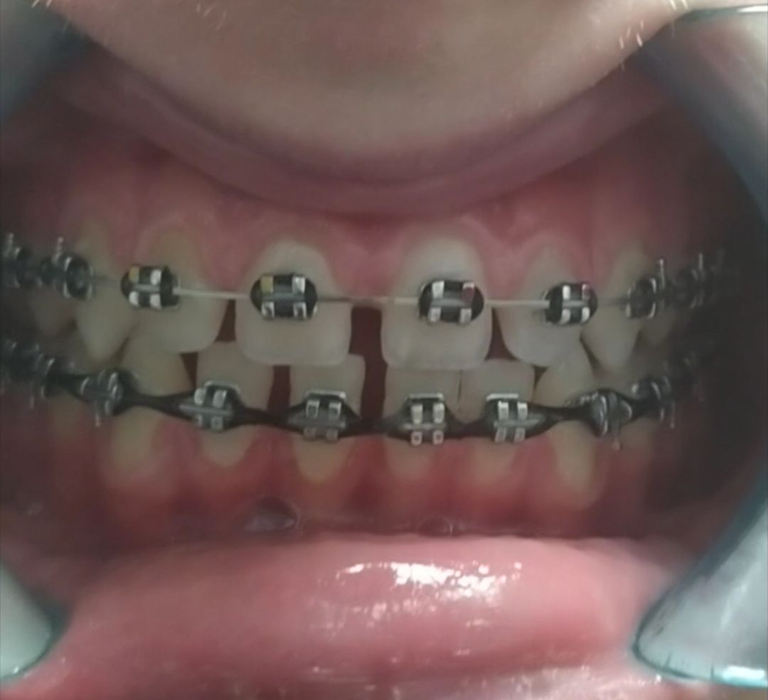 Marlena Strzępka-11