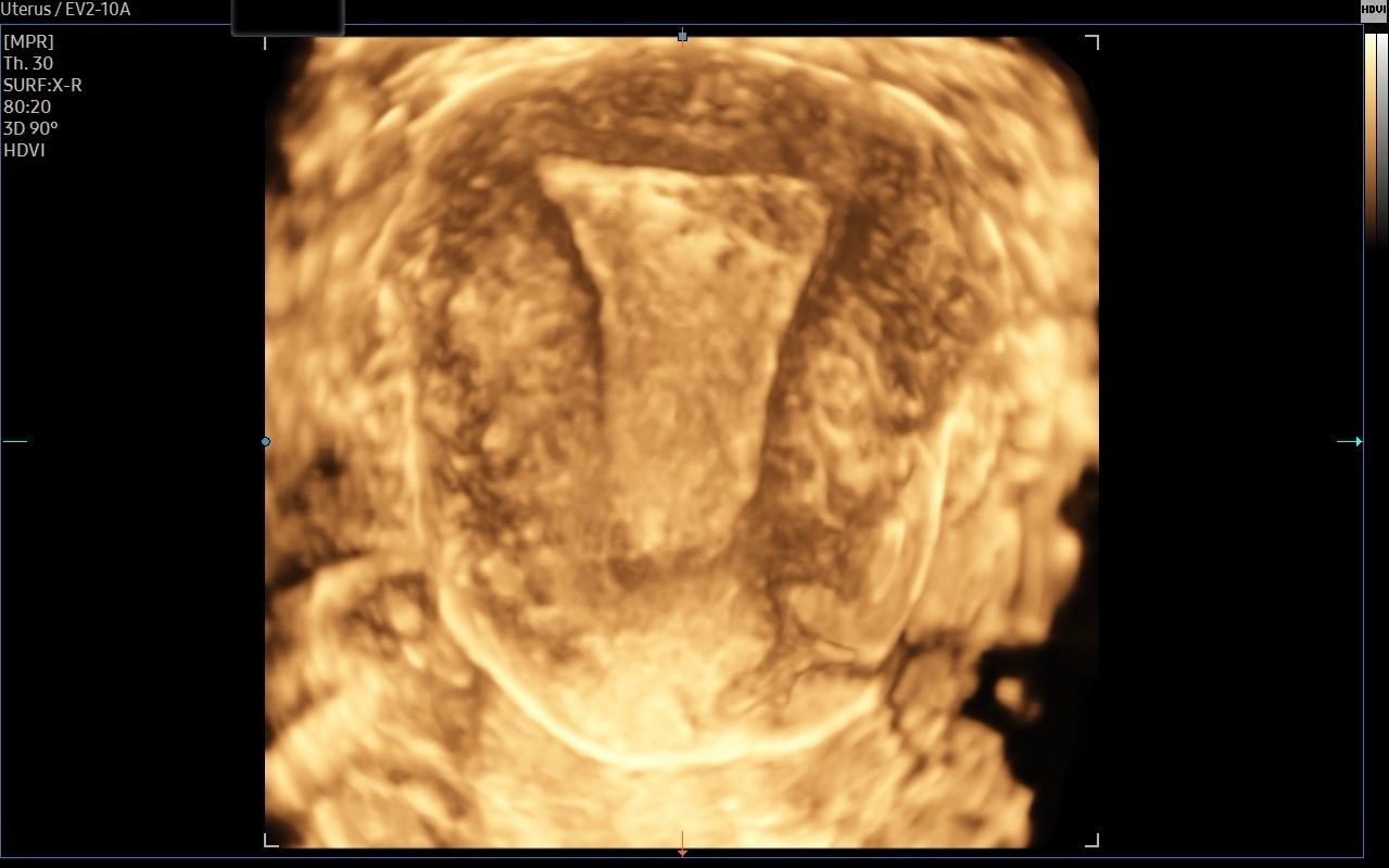 Valentina Del Negro-9