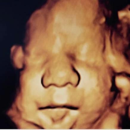 Memet Ali Kılçık-0