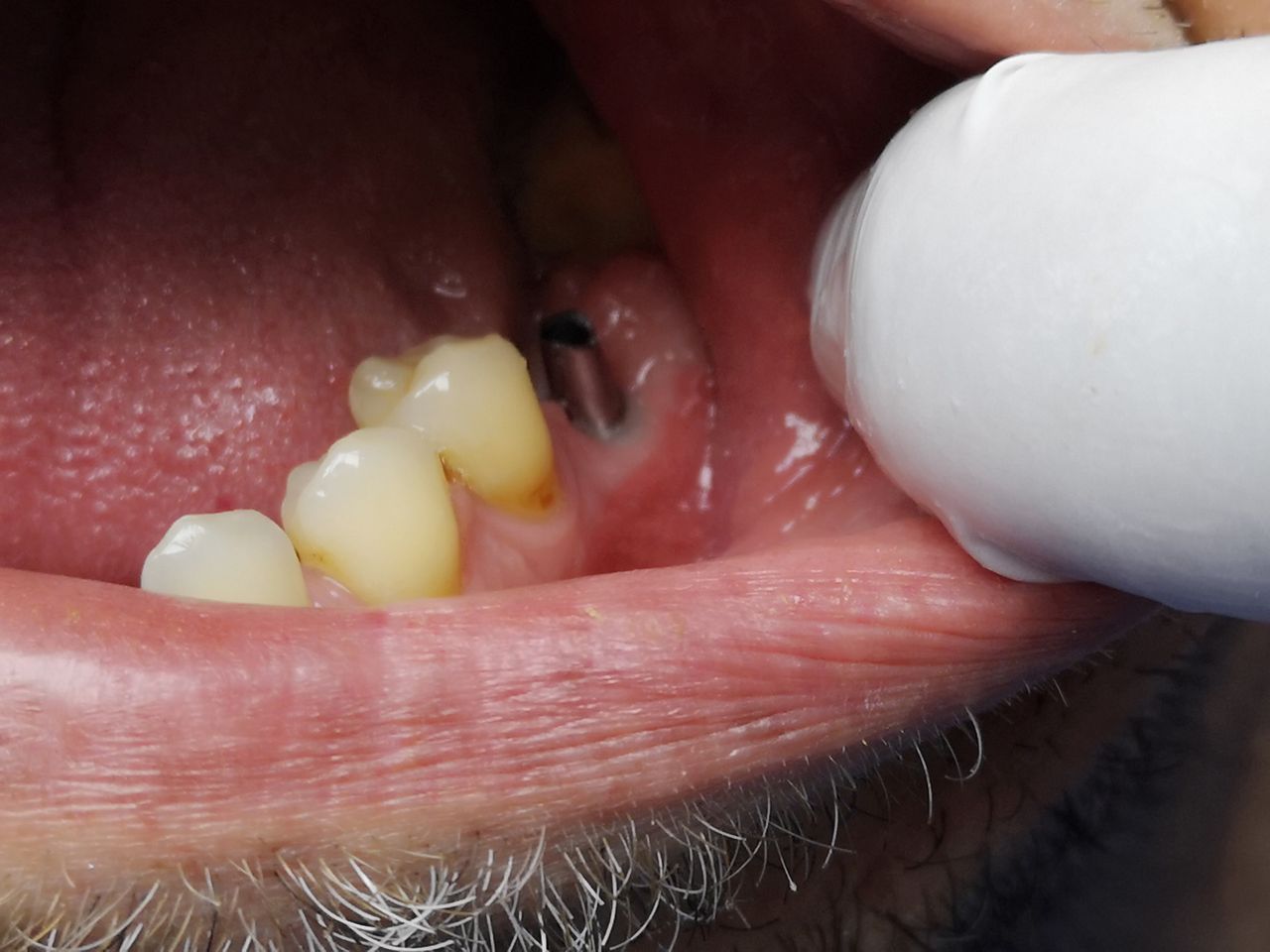 Stefano De Simone-118