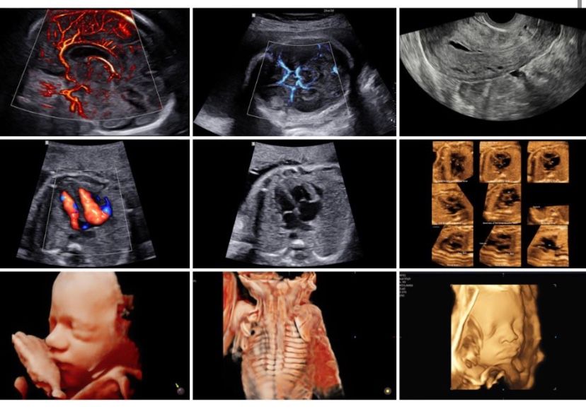 Paulina Kratochwil-1