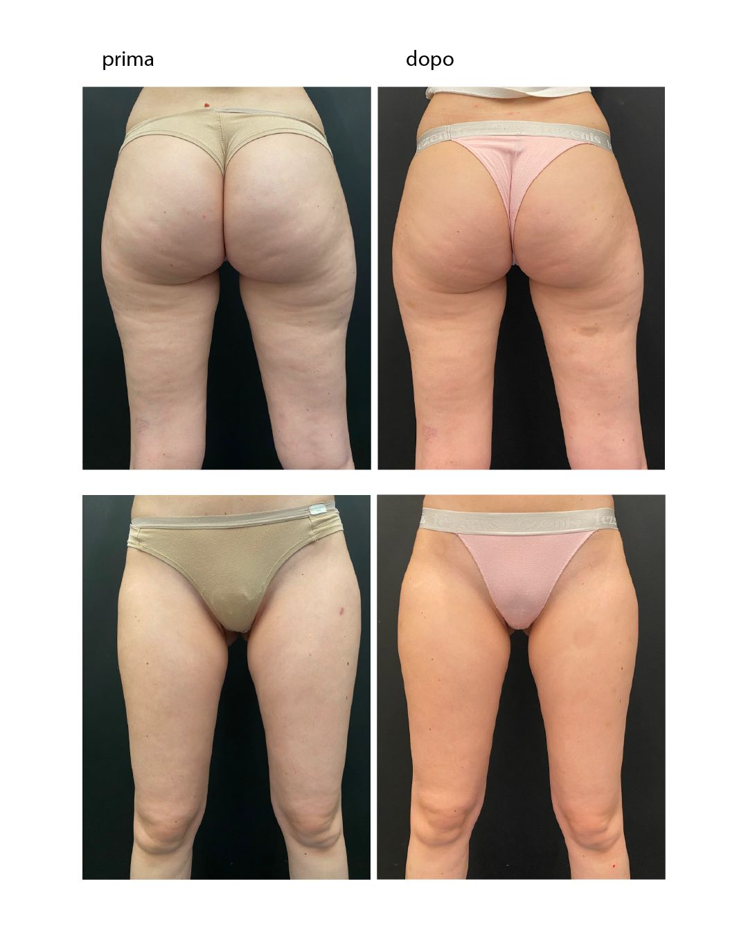 Liliana Turatello-13