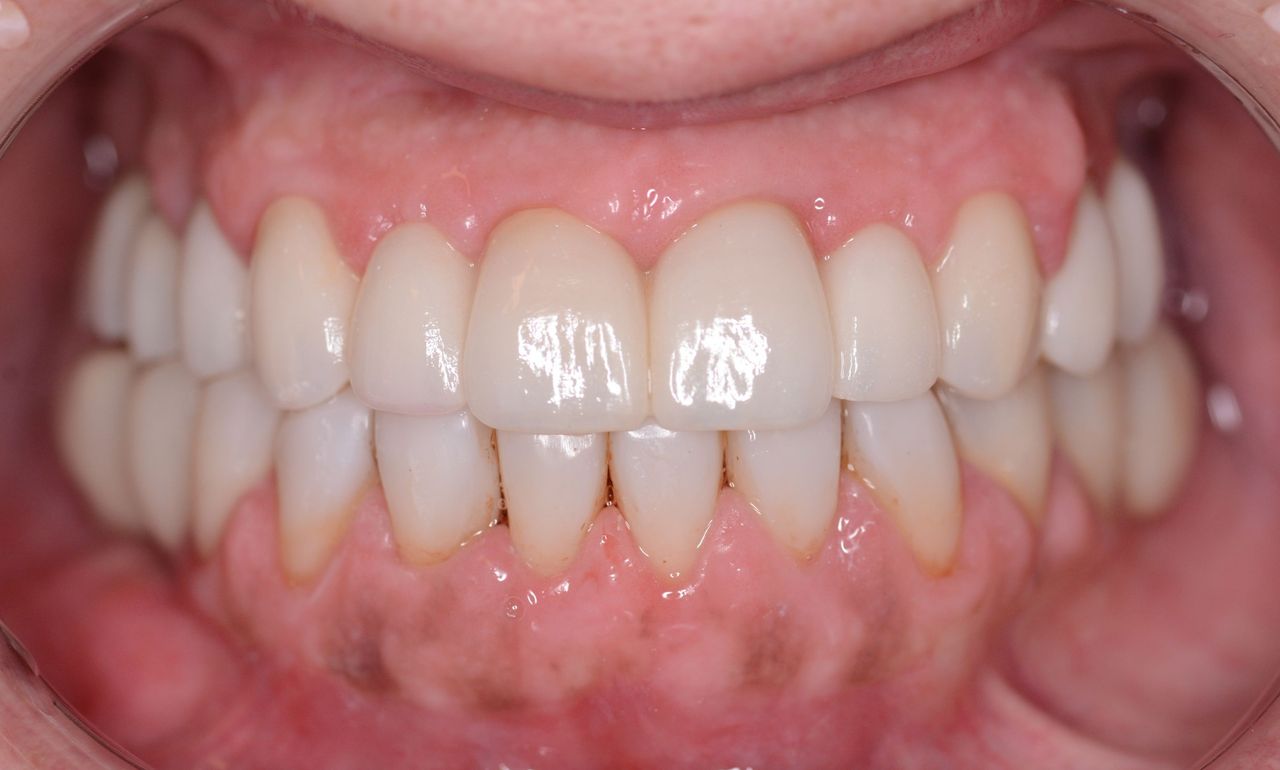 Magdalena Bińkowska-31