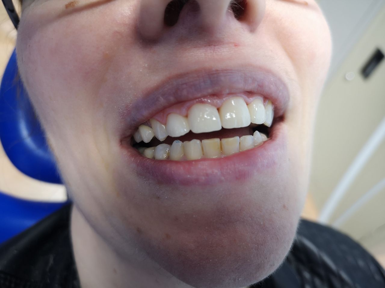 Stefano De Simone-114