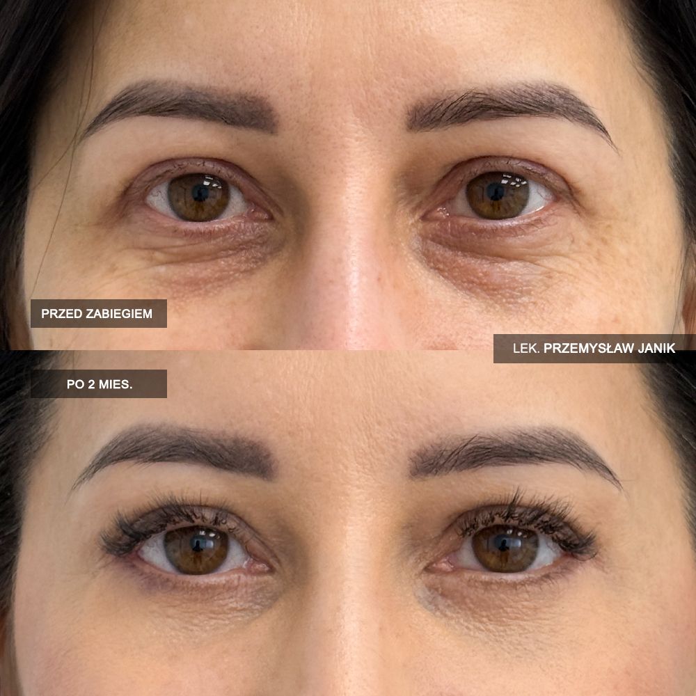 Przemysław Janik-69