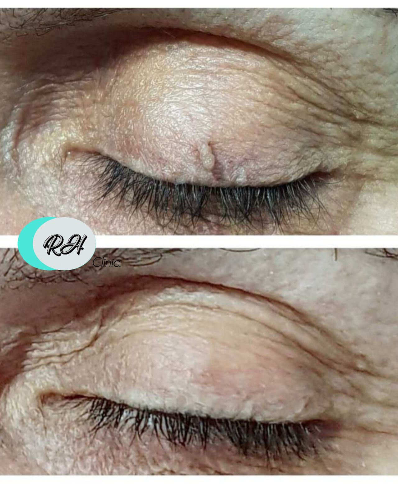 Rosalba Herrero Zerpa-589