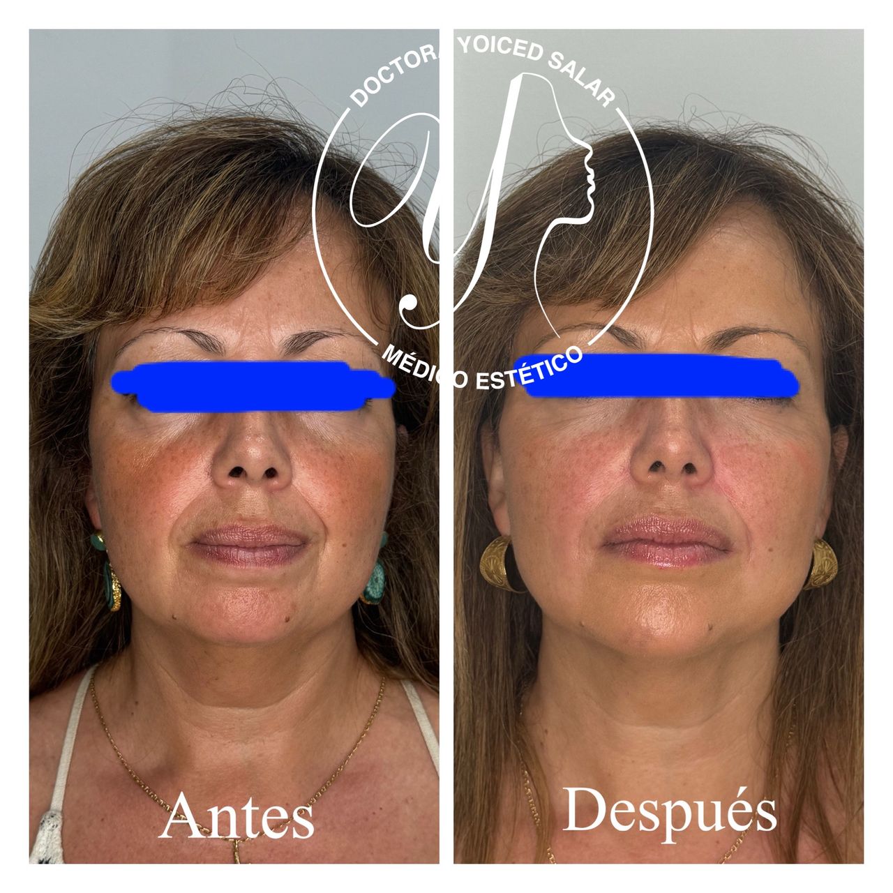 Yoiced Salar Peñate-32