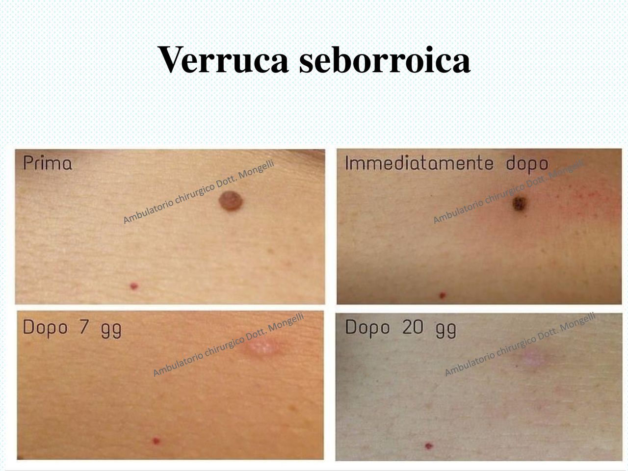 Matteo Antonio Mongelli-2