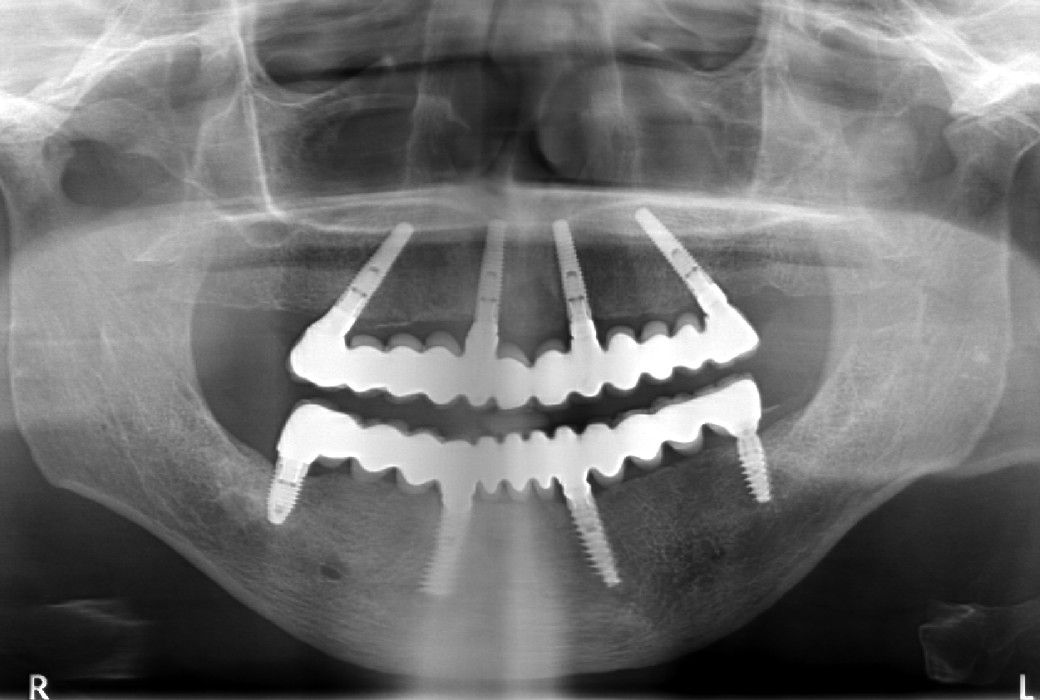 Alessandro Palumbo-27