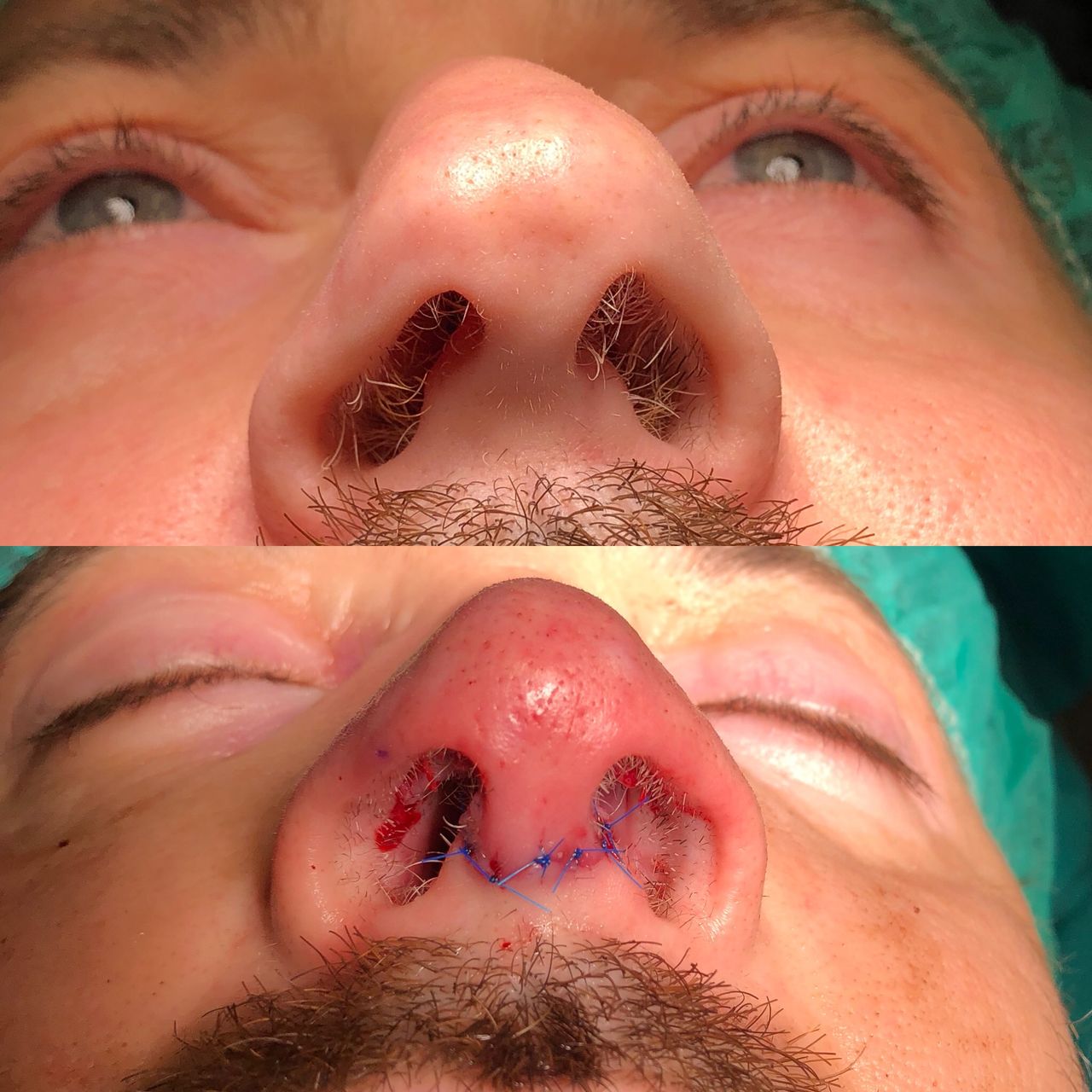 Alberto Candau Álvarez-25