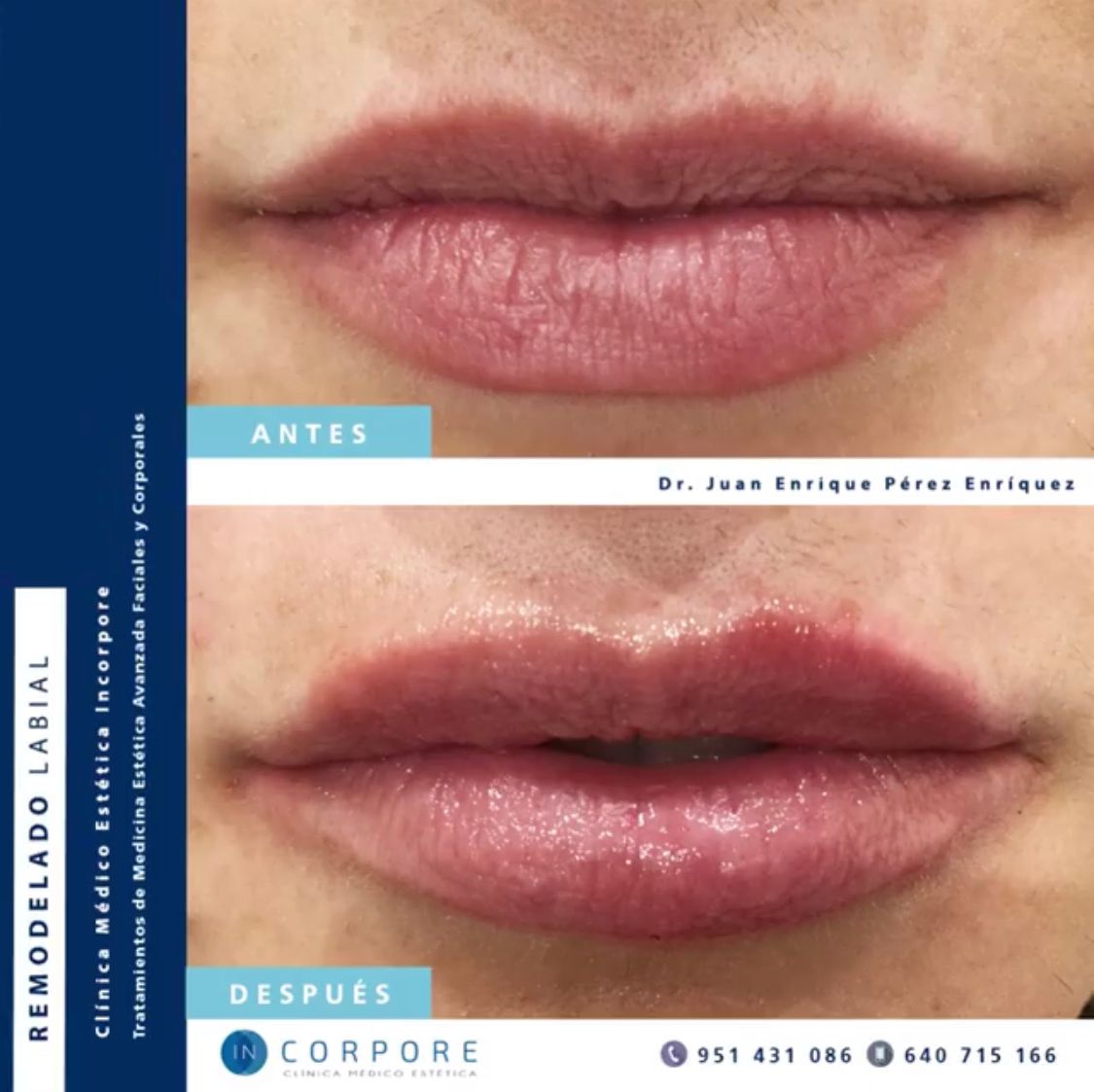 Juan Enrique Pérez Enríquez-84