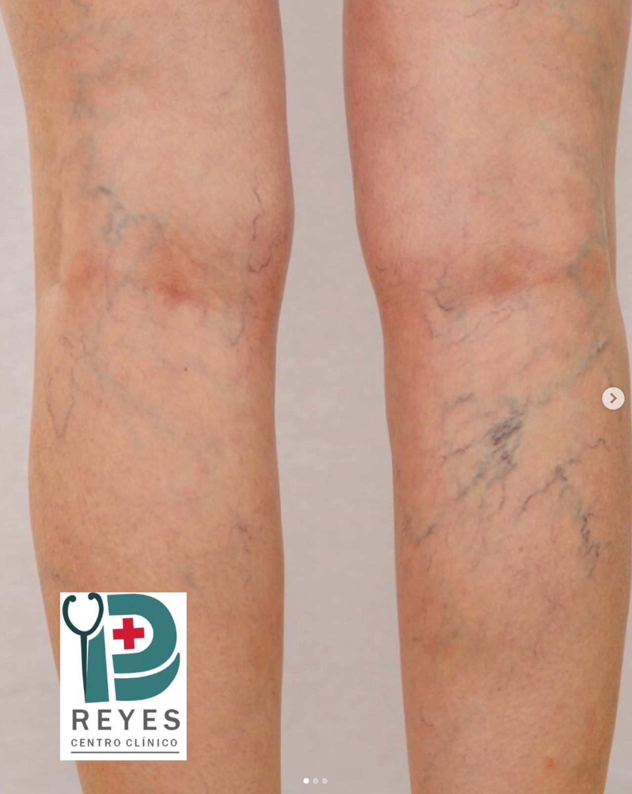 Josué Daniel Reyes Márquez-7