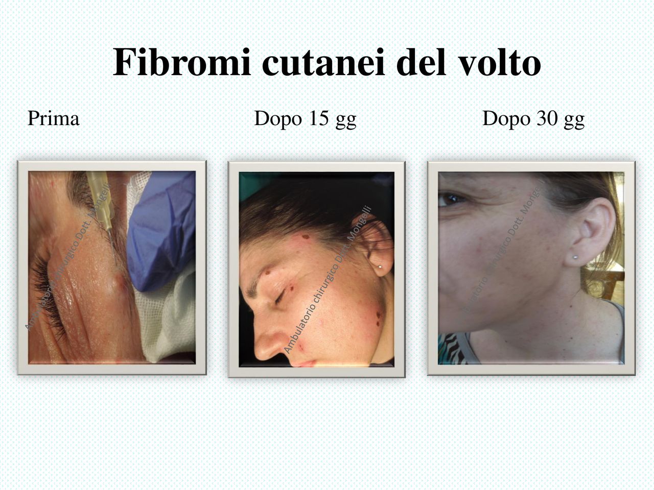 Matteo Antonio Mongelli-4