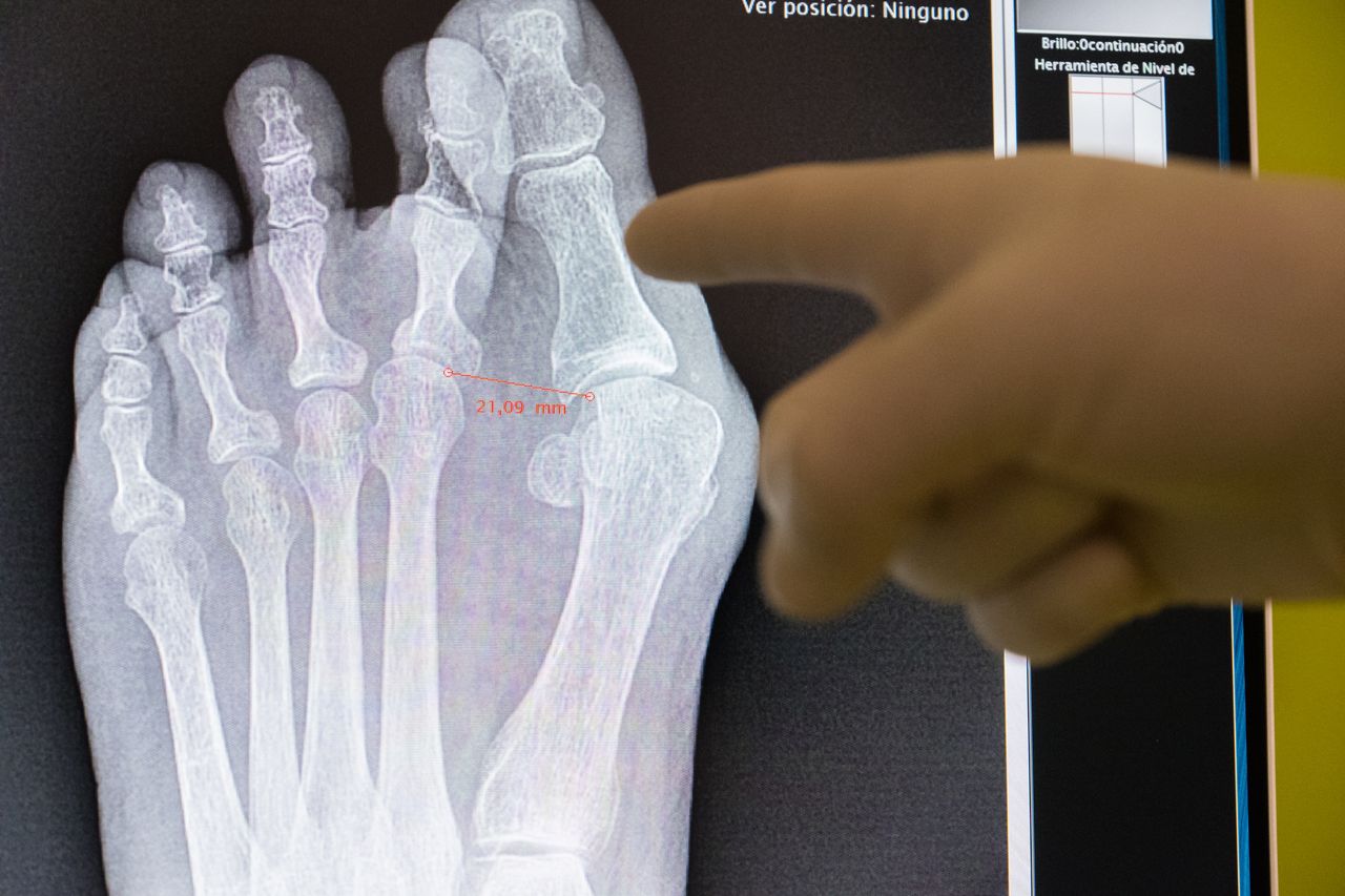 Alberto Caro Centeno-8