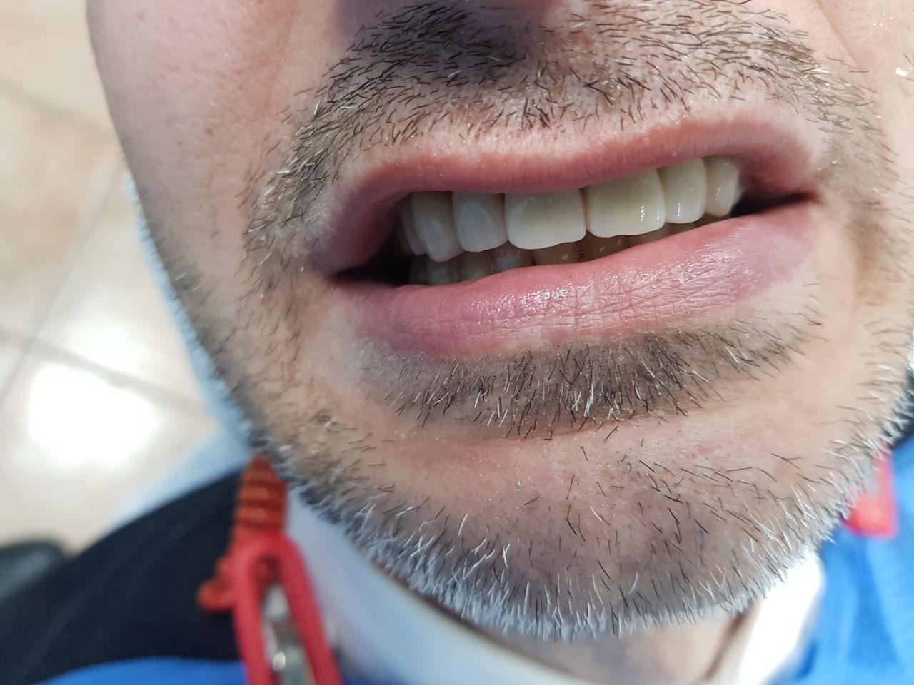 Stefano De Simone-108