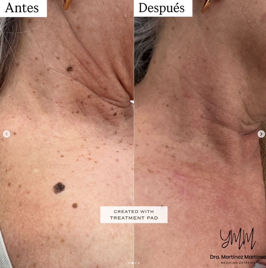 Yesliet Martínez Martínez-5