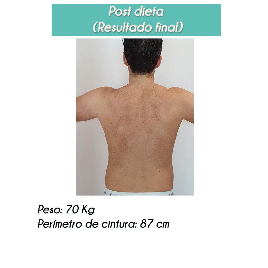 Rosalba Herrero Zerpa-327