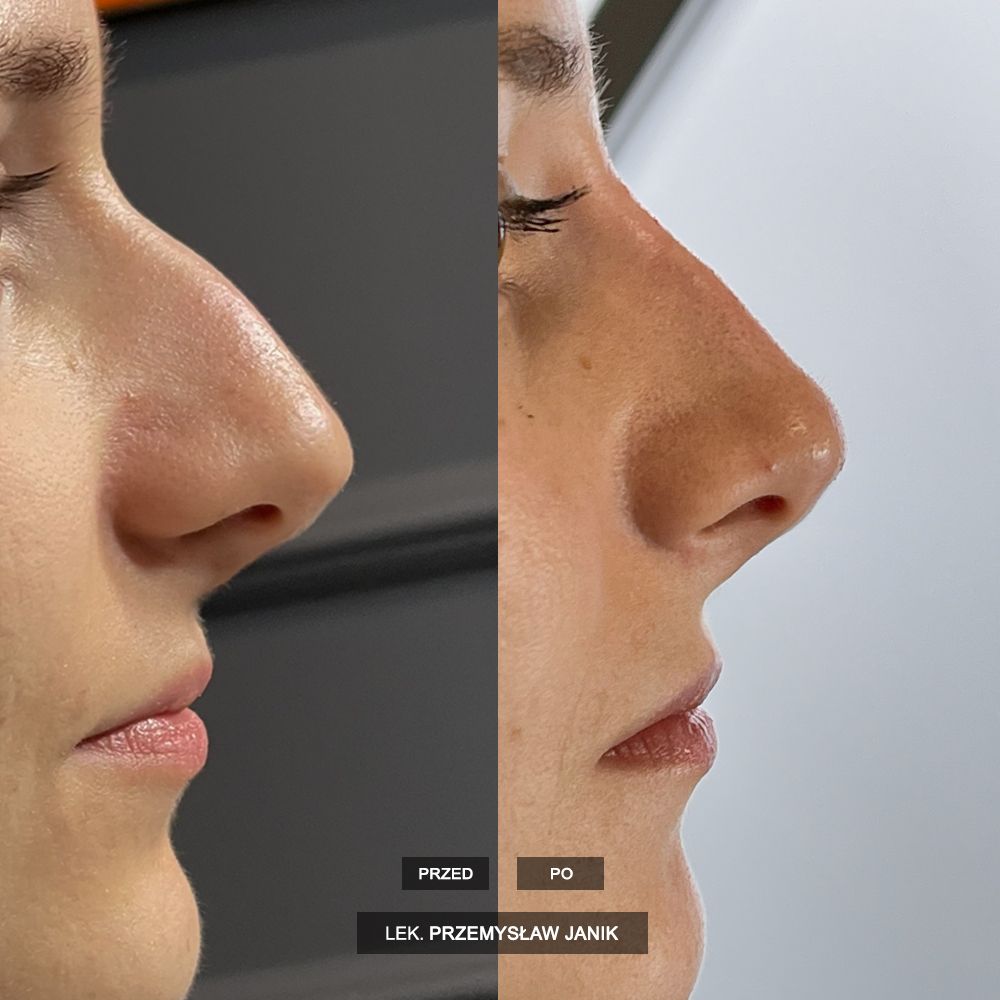 Przemysław Janik-51