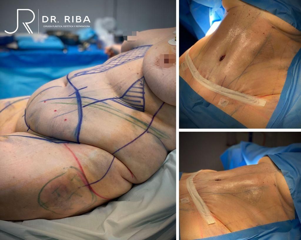 Jordi Riba Vilchez-33