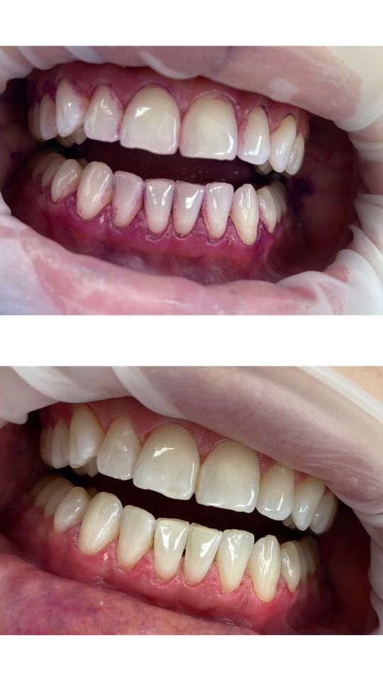 Waleria Szarblewska-1