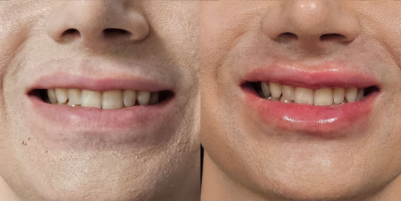 Rosalba Herrero Zerpa-455