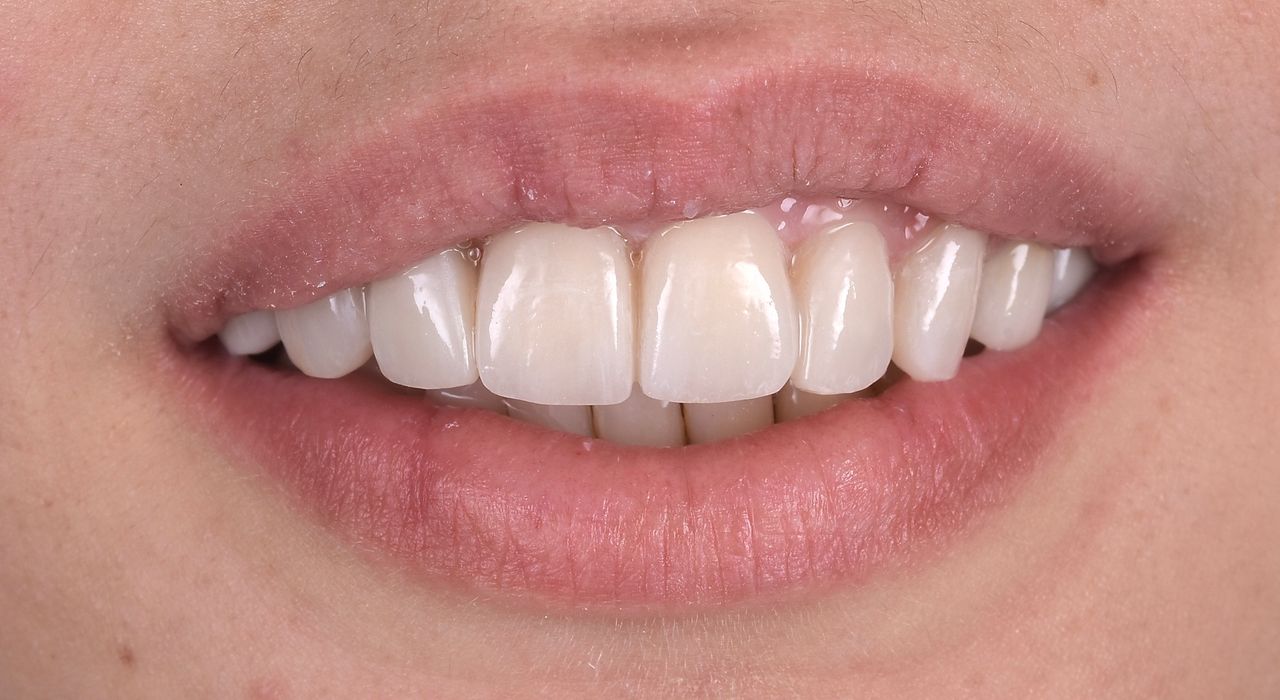 Riccardo Giardina-30