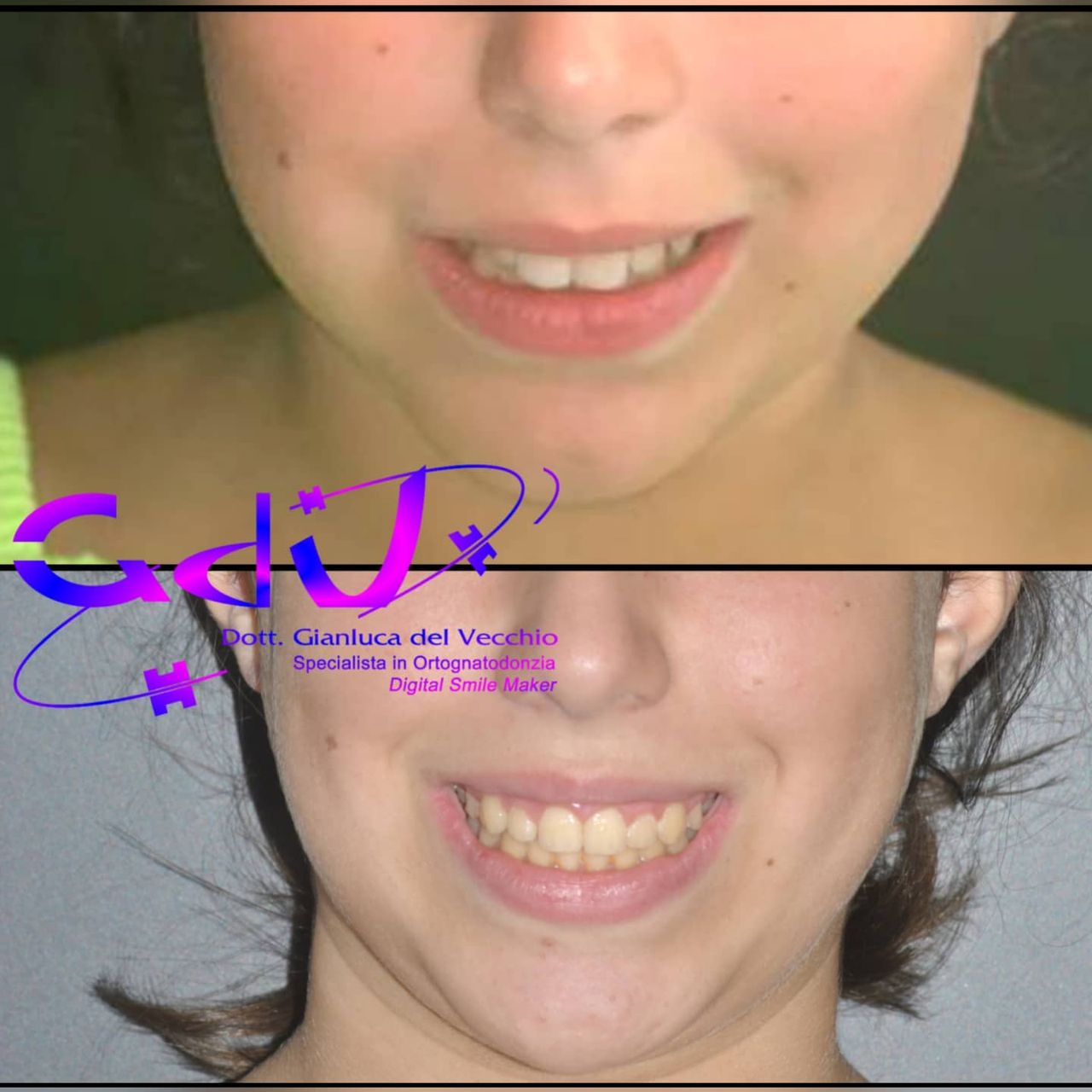 Gianluca Del Vecchio-123