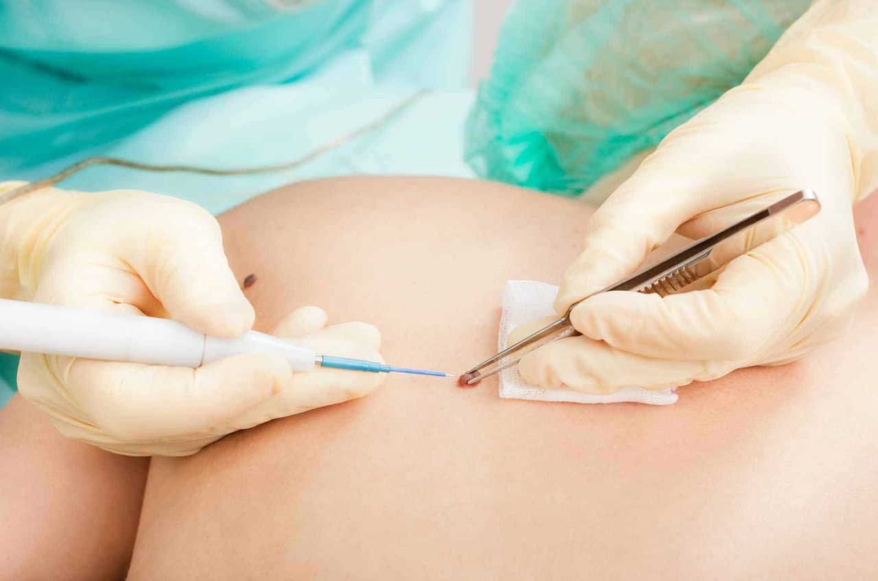 Katharina Schuppert-3