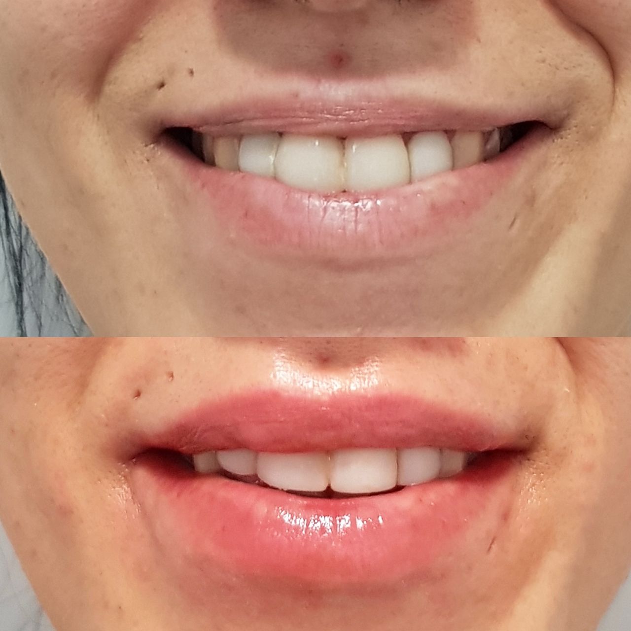 Rosalba Herrero Zerpa-321