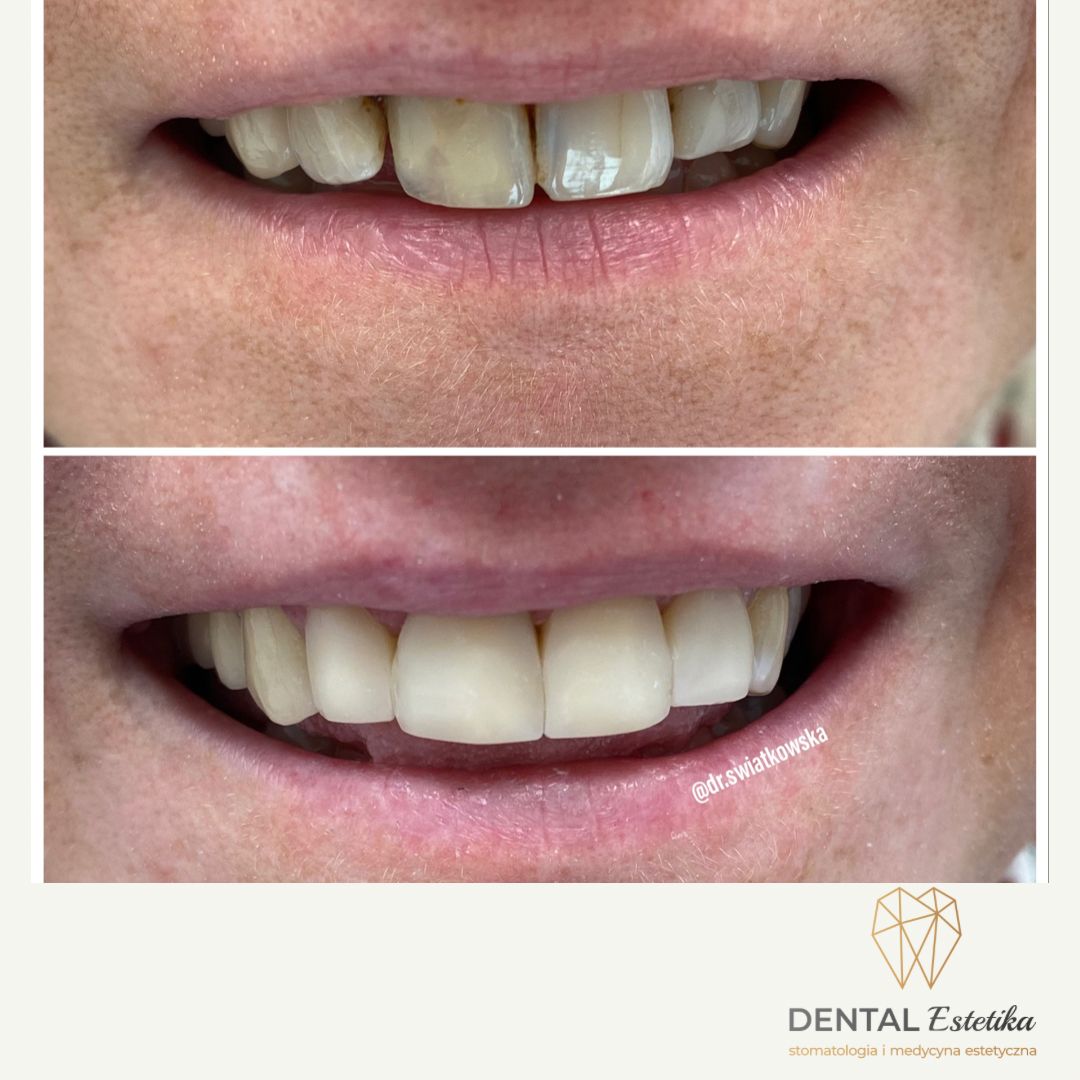 Angelika Świątkowska-15