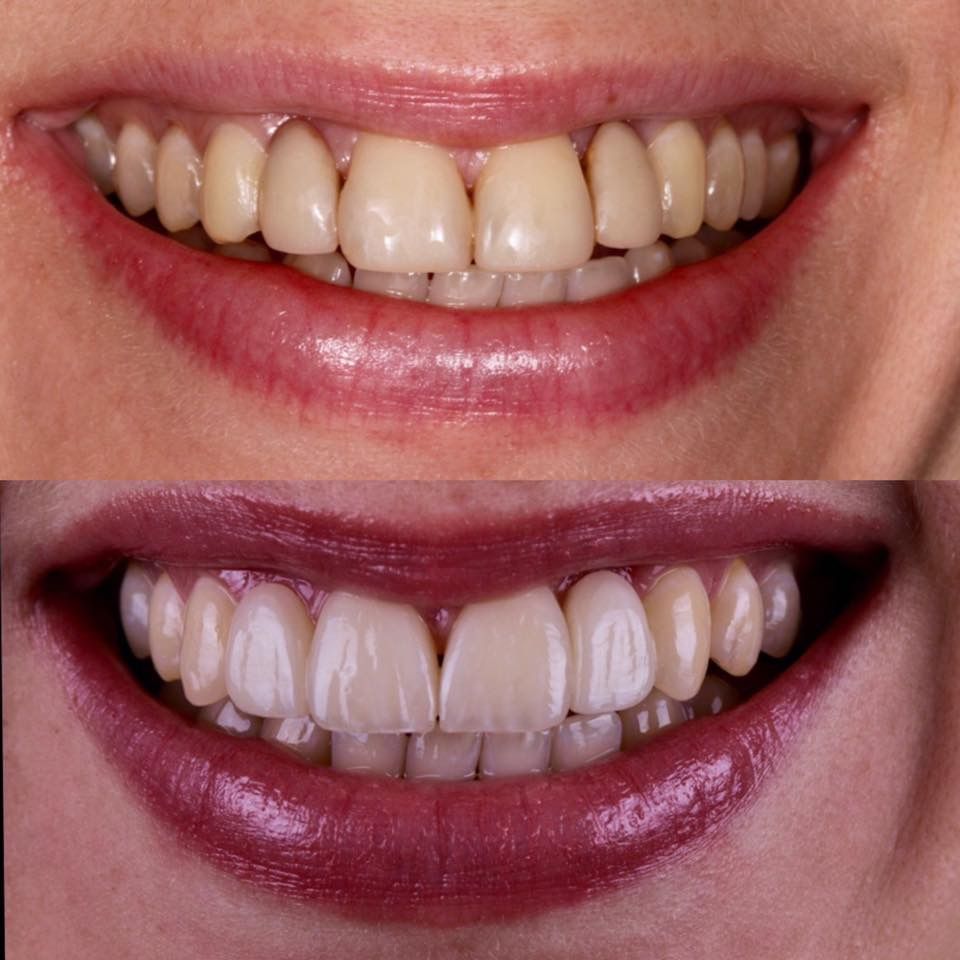 Volodymyr Kachmar-10