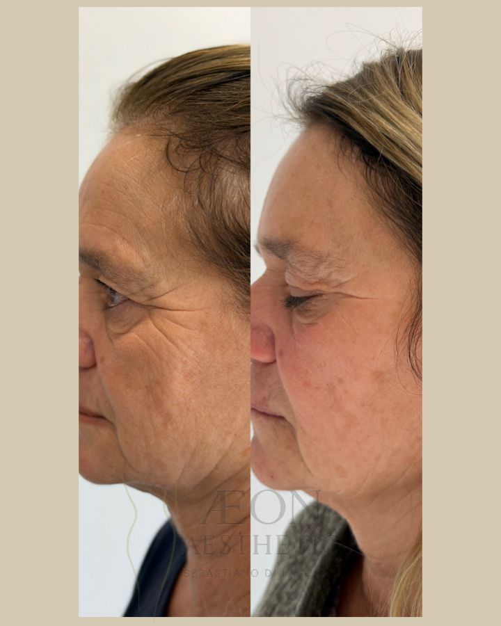 Sebastiano Di Lascio-14