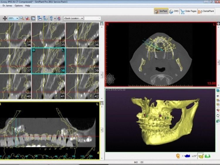 Alessandro Palumbo-56