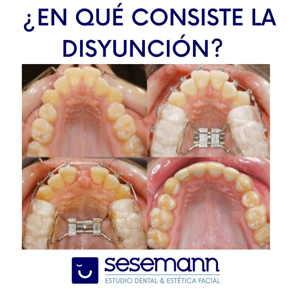 Paula Cano Carrillo-98