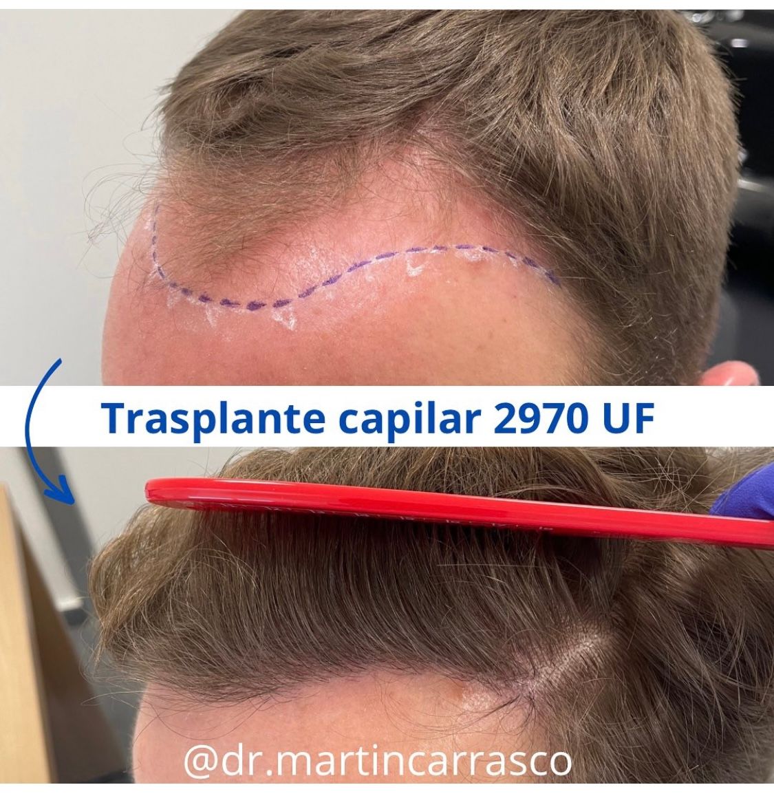 Pablo Martín Carrasco-4