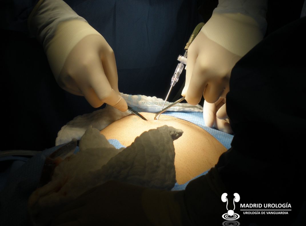 Luis Fernando Susaníbar Napurí-36