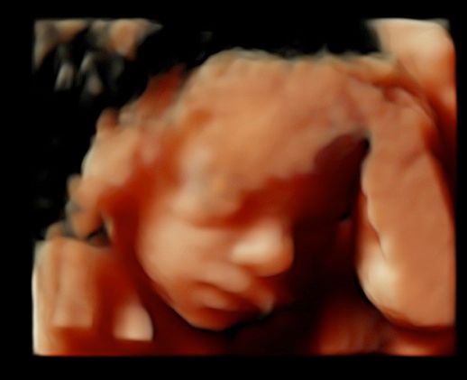 Tommaso Incandela-32