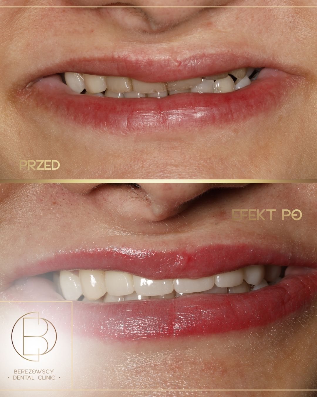 Emilia Gałązka-Tatarczak-1