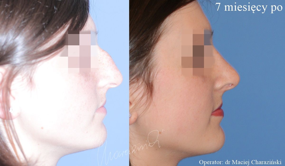 Maciej Charaziński-18