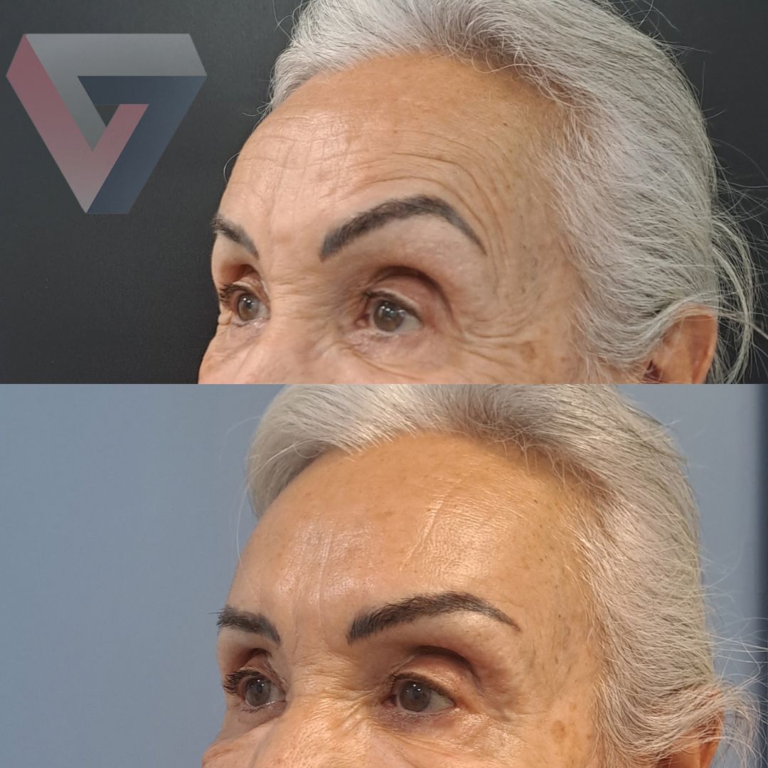 Victoria Trasmonte-128