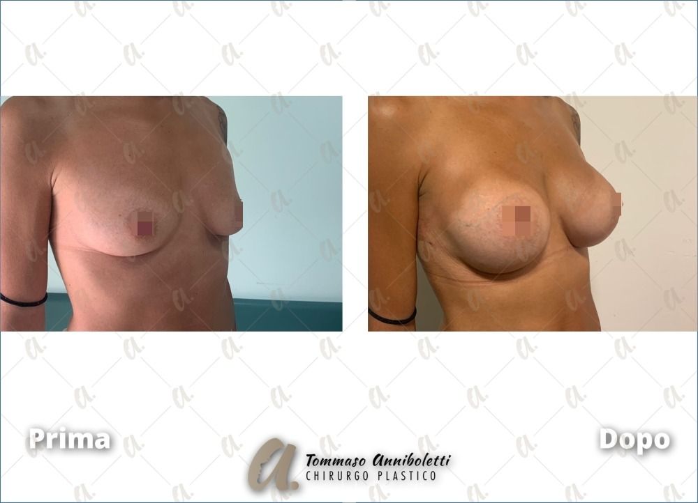 Tommaso Anniboletti-1