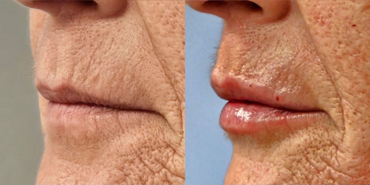 Rosalba Herrero Zerpa-567