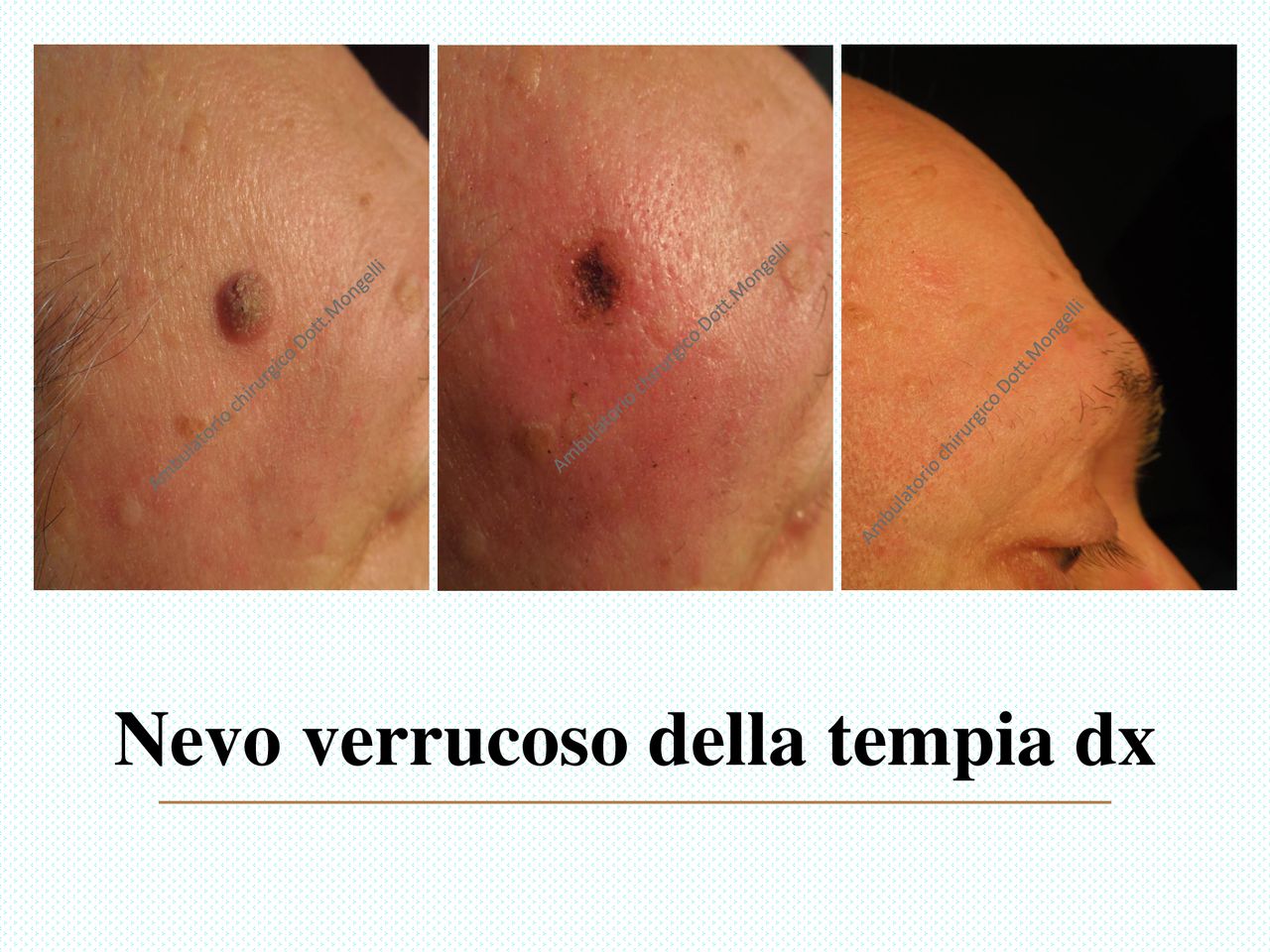 Matteo Antonio Mongelli-21