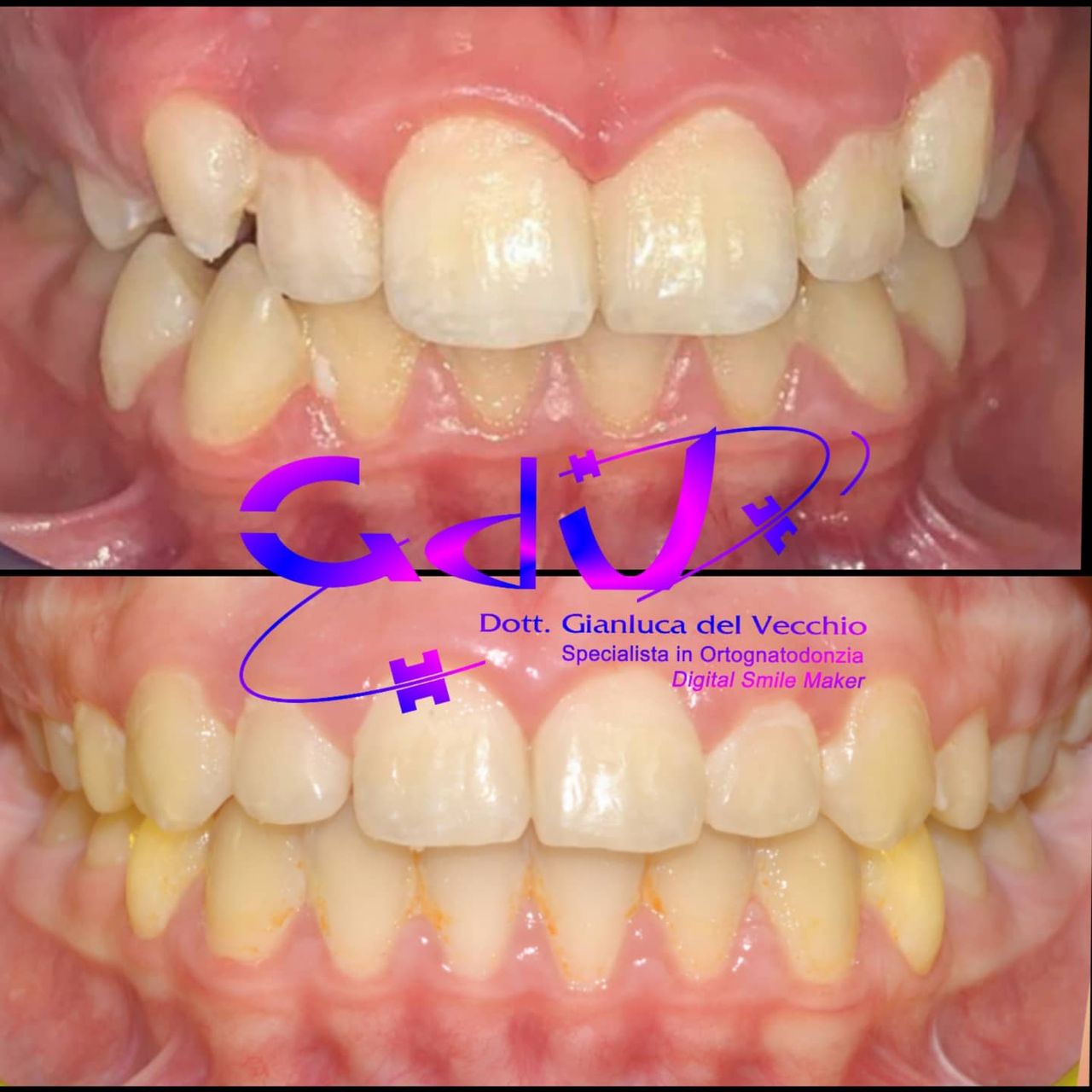 Gianluca Del Vecchio-120