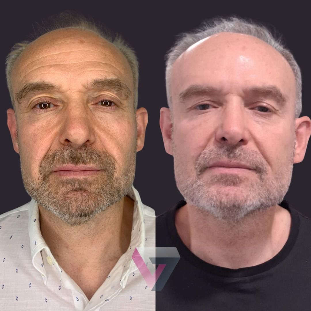 Victoria Trasmonte-121