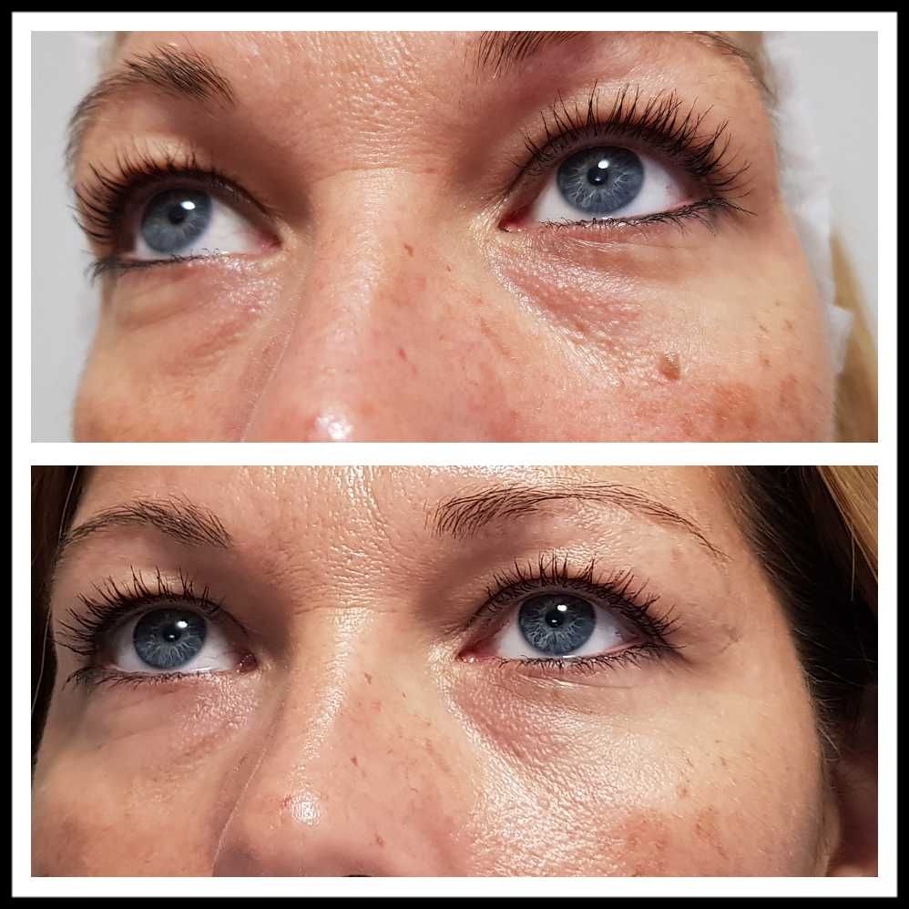 Rosalba Herrero Zerpa-357