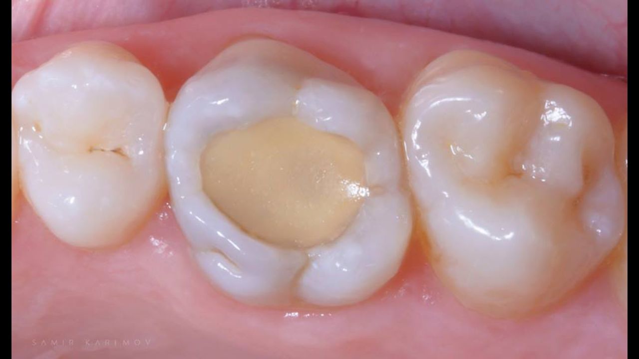 Volodymyr Kachmar-17